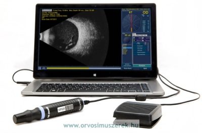Sw szemészeti ultrahang vizsgálat gép szonda ~ Mérési & elemzési eszközök - metalnews.hu