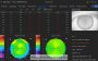 MEDIWORKS AL551 optikai biométer_myopia management