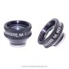 OCULAR OLIV-WENA NA WF/EQ Vitrectomy Lens Set OCULAR OLIV-WENA NA WF/EQ Vitrectomy Lens Set